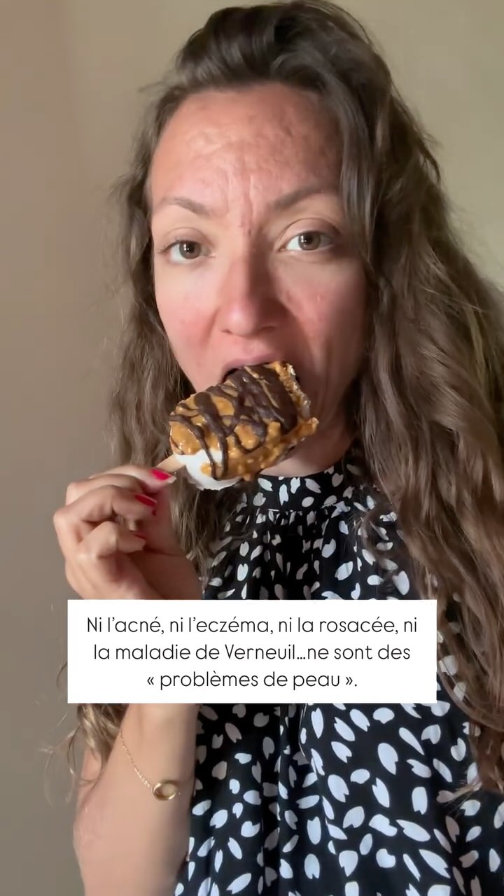 Je le dis sans cesse mais les problématiques de peau ne sont en rien de simples problèmes de peau mais les signes d’un organisme qui peine à gérer ses fonctions.
Lorsque les émonctoires principaux - comme le foie et les intestins - sont surchargés, le corps cherche d’autres voies pour éliminer ces déchets, et la peau en prend alors une bonne partie en charge. Ce processus de détoxification secondaire déclenche des réactions inflammatoires visibles, comme des boutons, des rougeurs, des plaques sèches ou grasses, en bref des lésions cutanées.
La peau est donc vraiment le reflet de la santé intérieure. Un foie surchargé, par exemple, aura du mal à filtrer les toxines et à réguler les hormones. Car oui c’est le foie qui s’occupe de recycler nos hormones.
Les intestins, notre deuxième cerveau, abritent une flore complexe qui influence notre immunité et notre réaction inflammatoire. Un déséquilibre du microbiote intestinal peut entraîner une perméabilité accrue de la barrière intestinale, laissant passer des toxines dans le sang et provoquant des réponses inflammatoires à travers le corps, y compris sur la peau.
Le système endocrinien, et notamment les glandes surrénales, est aussi à surveiller. Le stress chronique induit par un mode de vie exigeant peut épuiser ces glandes, entraînant une production accrue de cortisol, l’hormone du stress. Cette surproduction peut à son tour déstabiliser l’équilibre de la glycémie, augmentant les pics d’insuline, un autre facteur pro-inflammatoire pour la peau et jouer en cascade sur les hormones thyroïdiennes et sexuelles.
Pour retrouver une peau saine, il faut vraiment voir au-delà de l’épiderme. La peau est un messager de notre santé intérieure et seule, la skincare, ne suffira pas !
Commentes « CAUSES » pour recevoir quelques conseils concrets en DM ?
#naturopathie #micronutrition #problemesdepeau #acné #eczéma #psoriasis #verneuil #peaugrasse