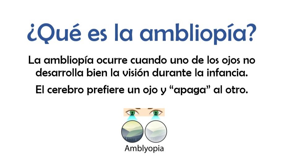 La ambliopía, también conocida como “ojo vago”, ocurre cuando un ojo no desarrolla correctamente la visión en la infancia.
Es una de las causas más comunes de pérdida visual evitable en niños ?.
Detectarla a tiempo puede cambiar el futuro visual de un niño.
?️ Revisiones anuales
? Tratamiento precoz
? Conciencia y prevención
? 15 de octubre – Día Mundial de la Ambliopía
#Ambliopía #OjoVago #SaludVisual #Prevención #OftalmologíaInfantil #DíaMundialDeLaAmbliopía